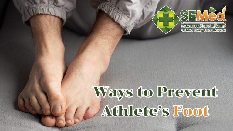 Ways to Prevent Athlete’s Foot EN
