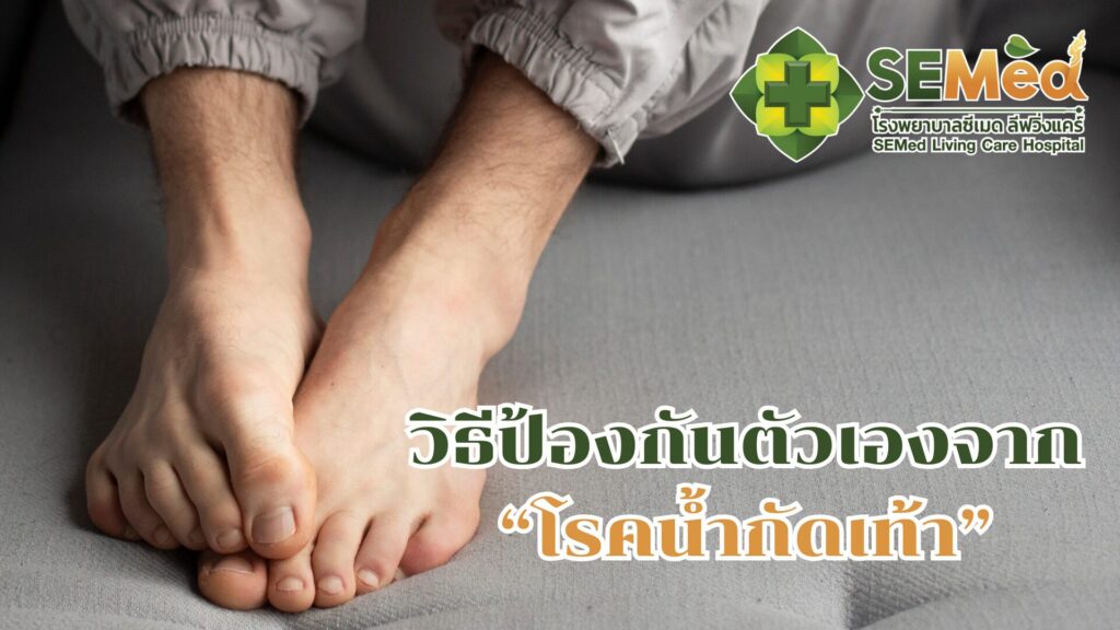 Ways to Prevent Athlete’s Foot TH