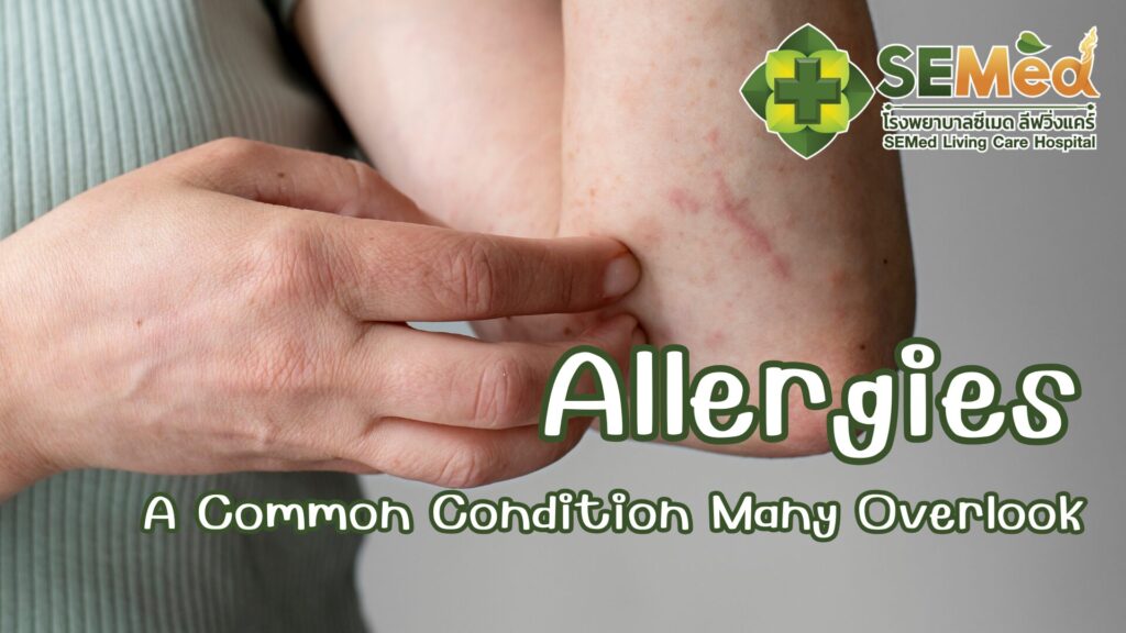 Allergies EN