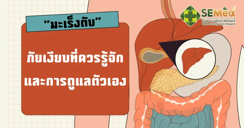 มะเร็งตับ