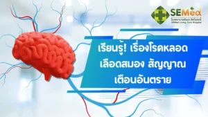 โรคหลอดเลือดสมอง (Stroke)