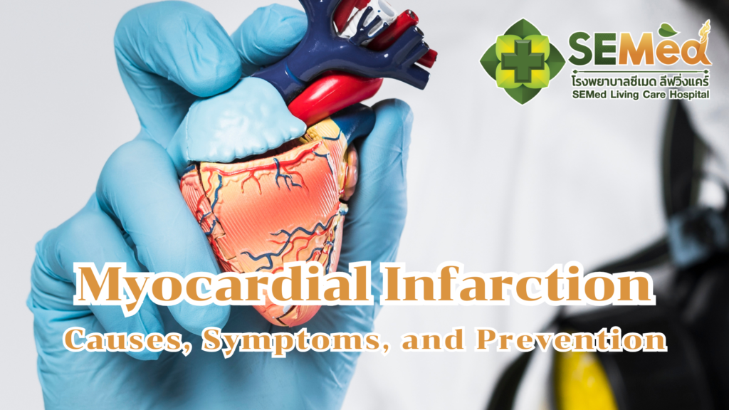 Myocardial Infarction EN