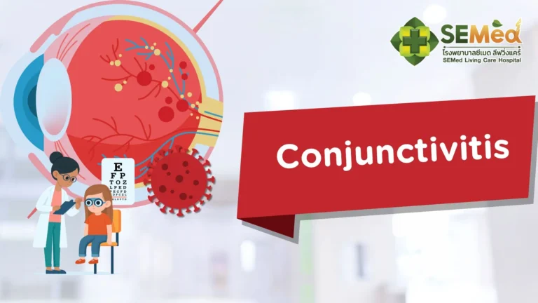 Conjunctivitis EN