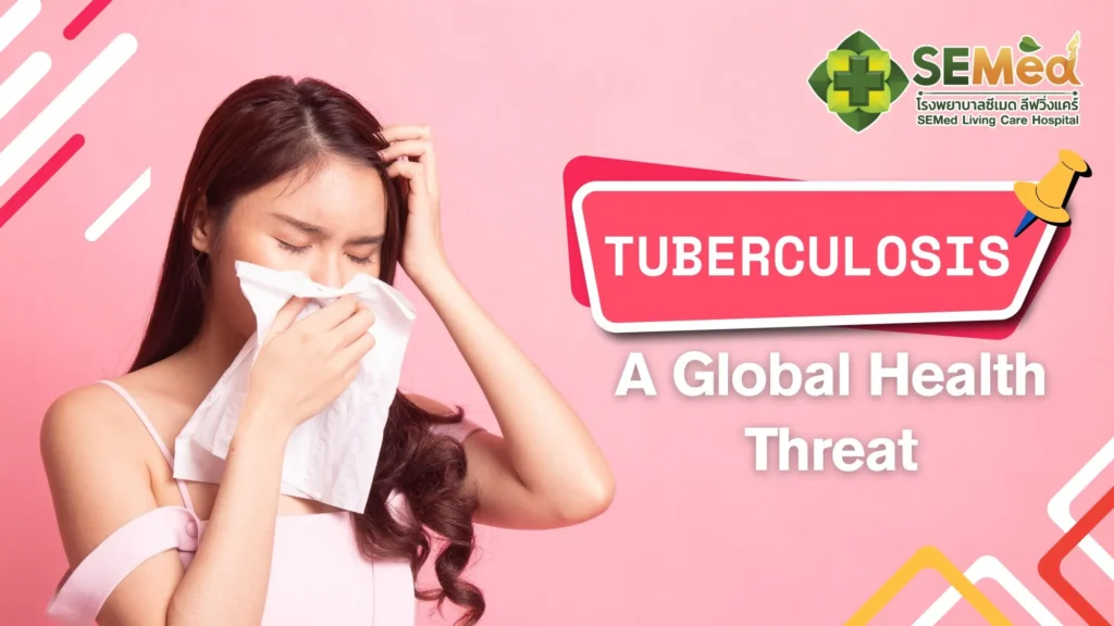 Tuberculosis EN